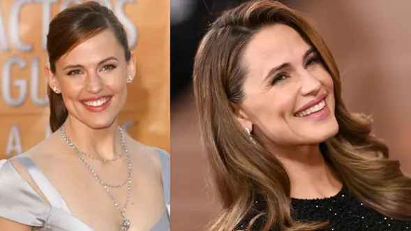 Jennifer Garner, antes y después de tratar su sonrisa gingival